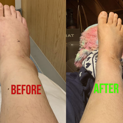 FootRenew Massager