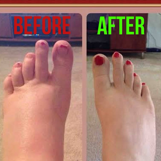 FootRenew Massager